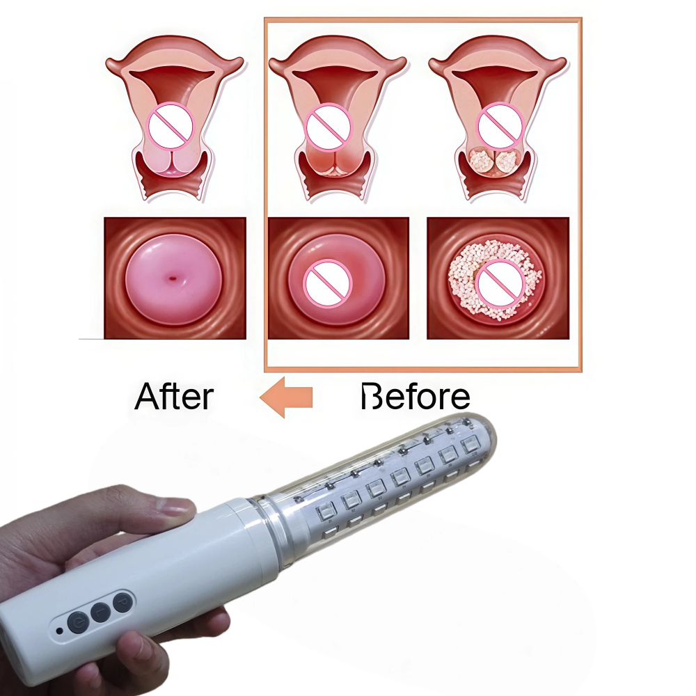 650nm LLLT Cold Laser Wand, Wo - Health Wellness Home Care บทวิจารณ์และราคา