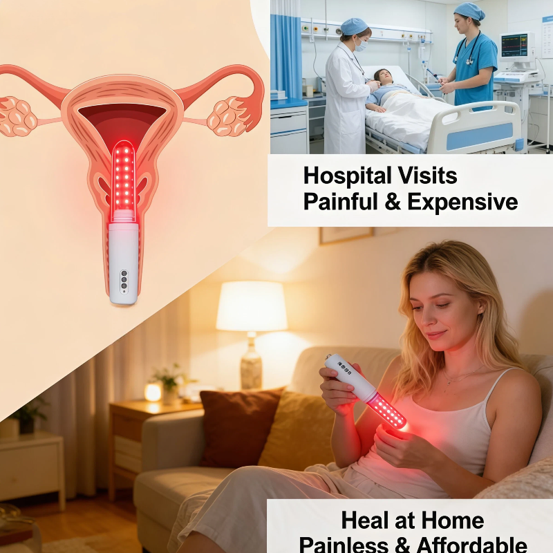 650nm LLLT Cold Laser Wand, Wo - Health Wellness Home Care บทวิจารณ์และราคา