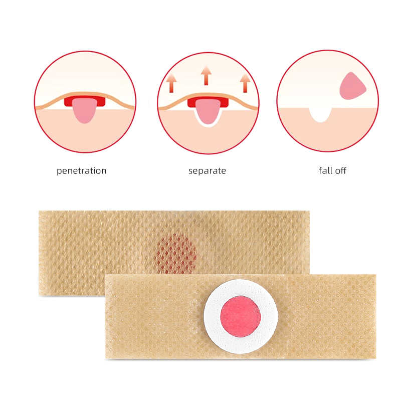 6PCS Foot Care Sticker Patch R - Detox Foot Patch บทวิจารณ์และราคา