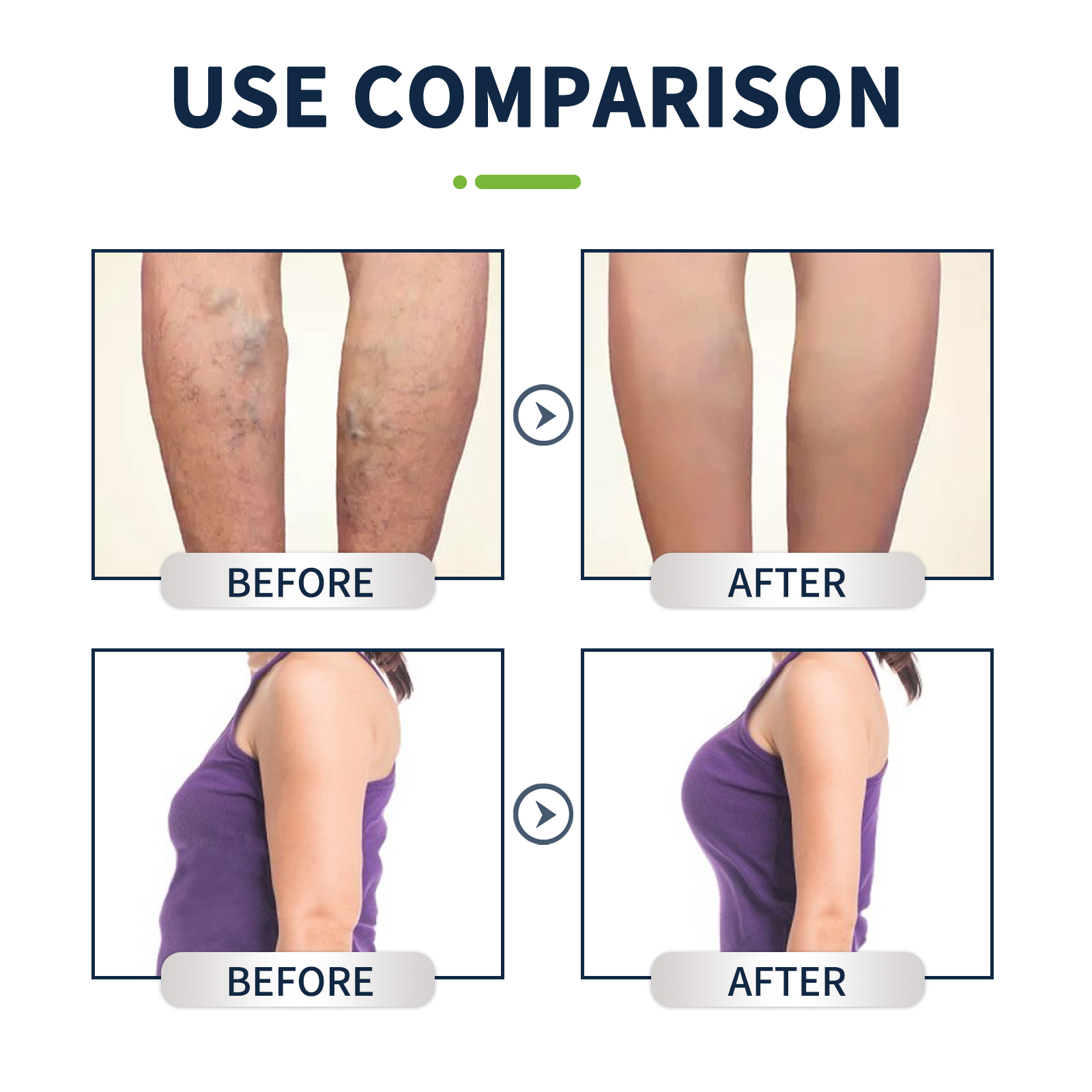 10pcs Foot Bath Gel Natural He - Detox Foot Patch บทวิจารณ์และราคา